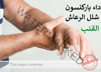 علاج داء باركنسون ونوبات شلل الرعاش بنبتة القنب