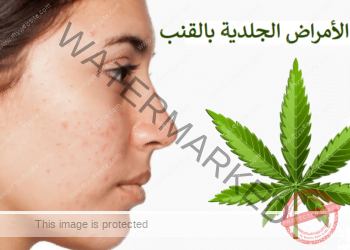 علاج الأمراض الجلدية باستخدام نبتة القنب